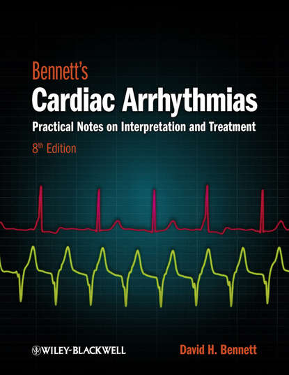 Bennett's Cardiac Arrhythmias. Practical Notes on Interpretation and Treatment
