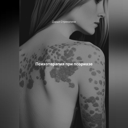 Психотерапия при псориазе
