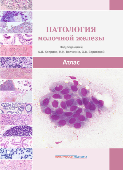 Патология молочной железы. Атлас