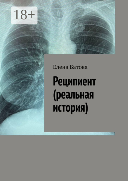 Реципиент (реальная история)