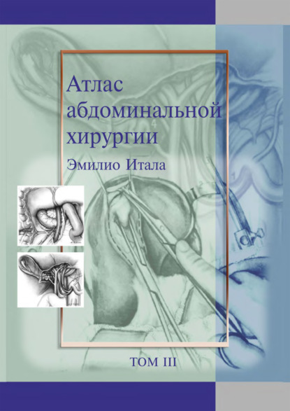 Атлас абдоминальной хирургии. Том 3. Хирургия тонкой и толстой кишки, прямой кишки и анальной области