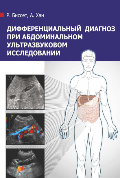 Дифференциальный диагноз при абдоминальном ультразвуковом исследовании