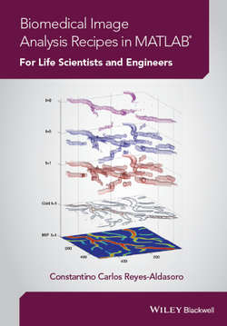 Biomedical Image Analysis Recipes in MATLAB. For Life Scientists and Engineers