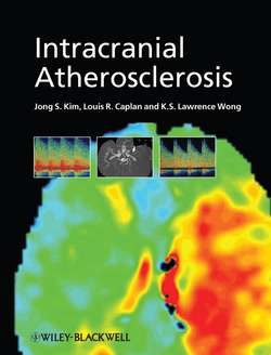 Intracranial Atherosclerosis