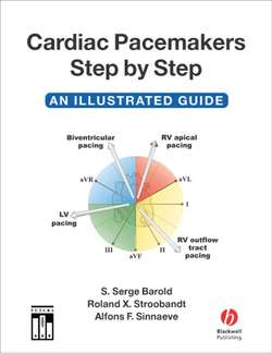 Cardiac Pacemakers Step-by-Step