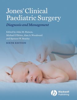 Jones' Clinical Paediatric Surgery