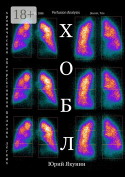 ХОБЛ. Хроническая обструктивная болезнь лёгких