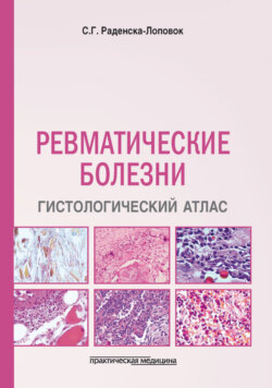 Ревматические болезни. Гистологический атлас