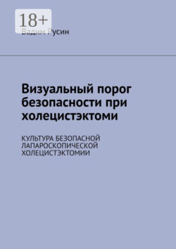 Визуальный порог безопасности при холецистэктоми. Культура безопасной лапароскопической холецистэктомии