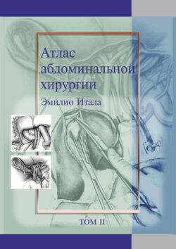 Атлас абдоминальной хирургии. Том 2. Хирургия желудка и двенадцатиперстной кишки