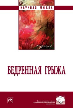 Бедренная грыжа