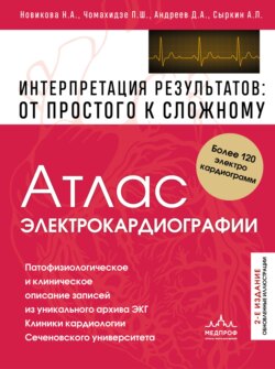Атлас электрокардиографии. Интерпретация результатов: от простого к сложному. 2-е издание