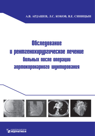 Обследование и рентгенохирургическое лечение больных после операции аортокоронарного шунтирования