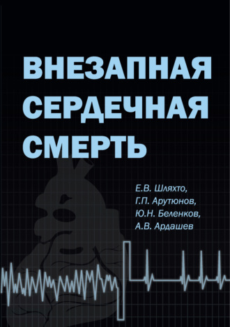 Внезапная сердечная смерть