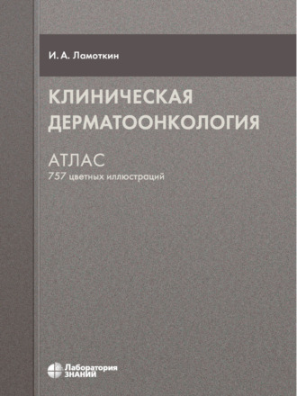 Клиническая дерматоонкология. Атлас