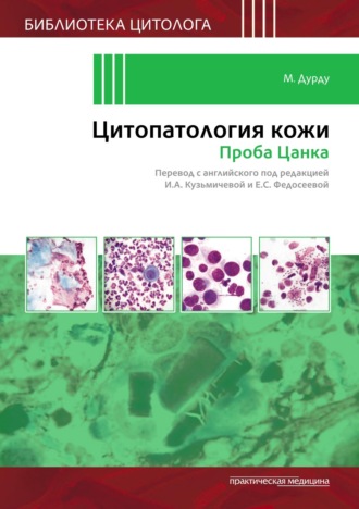 Цитопатология кожи. Проба Цанка