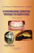Клиновидные дефекты твердых тканей зубов