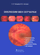 Окклюзии вен сетчатки (этиология, патогенез, клиника, диагностика, лечение)