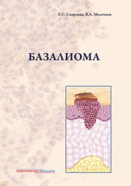 Базалиома